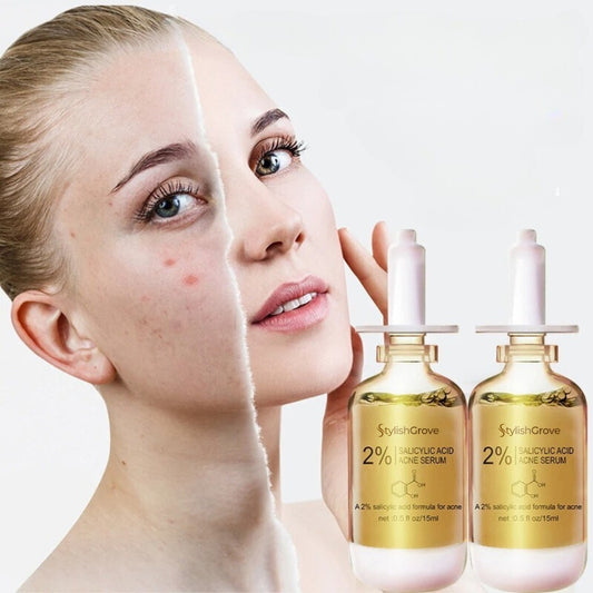 Acne Warrior Serum: 2% Salicylic Acid Power